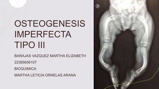 OSTEOGENESIS
IMPERFECTA
TIPO III
BARAJAS VAZQUEZ MARTHA ELIZABETH
22385656107
BIOQUIMICA
MARTHA LETICIA ORNELAS ARANA
 