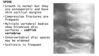 SPINE
• Growth is normal but they
are osteoporotic and have
thin cortical margins
• Compression fractures are
frequent
• Multiple vertebral bodies
show biconcave disc
surfaces – codfish
vertebrae
• Intervertebral disc spaces
may be widened
• Scoliosis is frequent
 