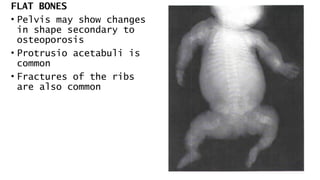 FLAT BONES
• Pelvis may show changes
in shape secondary to
osteoporosis
• Protrusio acetabuli is
common
• Fractures of the ribs
are also common
 