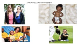 SOME PEOPLE LIVING WITH THE DISEASE
 