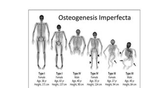 Osteogenesis imperfecta by Dr Aniket 