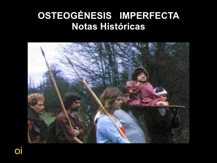 Osteogenesis imperfecta, definicion y tratamiento medico Osteogenesis imperfecta, definicion y tratamiento medico