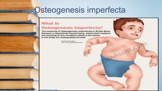 Osteogenesis imperfecta
 