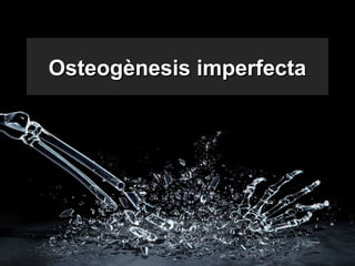 Osteogènesis imperfectaOsteogènesis imperfecta
 