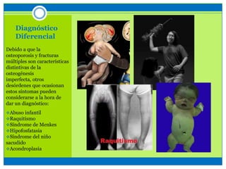 Diagnóstico
Diferencial
Debido a que la
osteoporosis y fracturas
múltiples son características
distintivas de la
osteogénesis
imperfecta, otros
desórdenes que ocasionan
estos síntomas pueden
considerarse a la hora de
dar un diagnóstico:
Abuso infantil
Raquitismo
Síndrome de Menkes
Hipofosfatasia
Síndrome del niño
sacudido
Acondroplasia
 