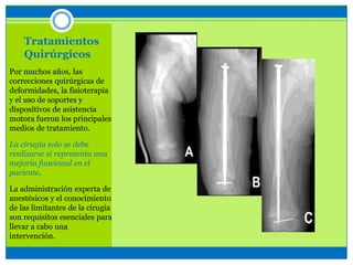 Tratamientos
Quirúrgicos
Por muchos años, las
correcciones quirúrgicas de
deformidades, la fisioterapia
y el uso de soportes y
dispositivos de asistencia
motora fueron los principales
medios de tratamiento.
La cirugía solo se debe
realizarse si representa una
mejoría funcional en el
paciente.
La administración experta de
anestésicos y el conocimiento
de las limitantes de la cirugía
son requisitos esenciales para
llevar a cabo una
intervención.
 