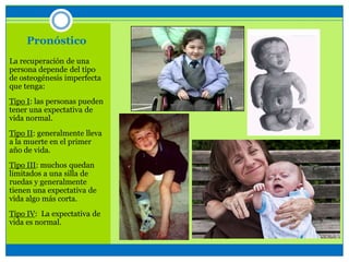 Pronóstico
La recuperación de una
persona depende del tipo
de osteogénesis imperfecta
que tenga:
Tipo I: las personas pueden
tener una expectativa de
vida normal.
Tipo II: generalmente lleva
a la muerte en el primer
año de vida.
Tipo III: muchos quedan
limitados a una silla de
ruedas y generalmente
tienen una expectativa de
vida algo más corta.
Tipo IV: La expectativa de
vida es normal.
 