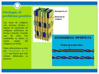 Etiología: el
problema genético
Las varas de colágeno
son uniones fuertes y
rígidas de moléculas de
colágeno uniformes en
forma y tamaño. Cuando
una de estas dos
cualidades se altera, la
unión rígida del
colágeno no existe.
Estas alteraciones se dan
por mutaciones en el
ADN que hacen que más
células deficientes se
generen.
 