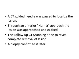 • A CT guided needle was passed to localize the
lesion.
• Through an anterior "Hernia" approach the
lesion was approached and excised.
• The Follow-up CT Scanning done to reveal
complete removal of lesion.
• A biopsy confirmed it later.

 