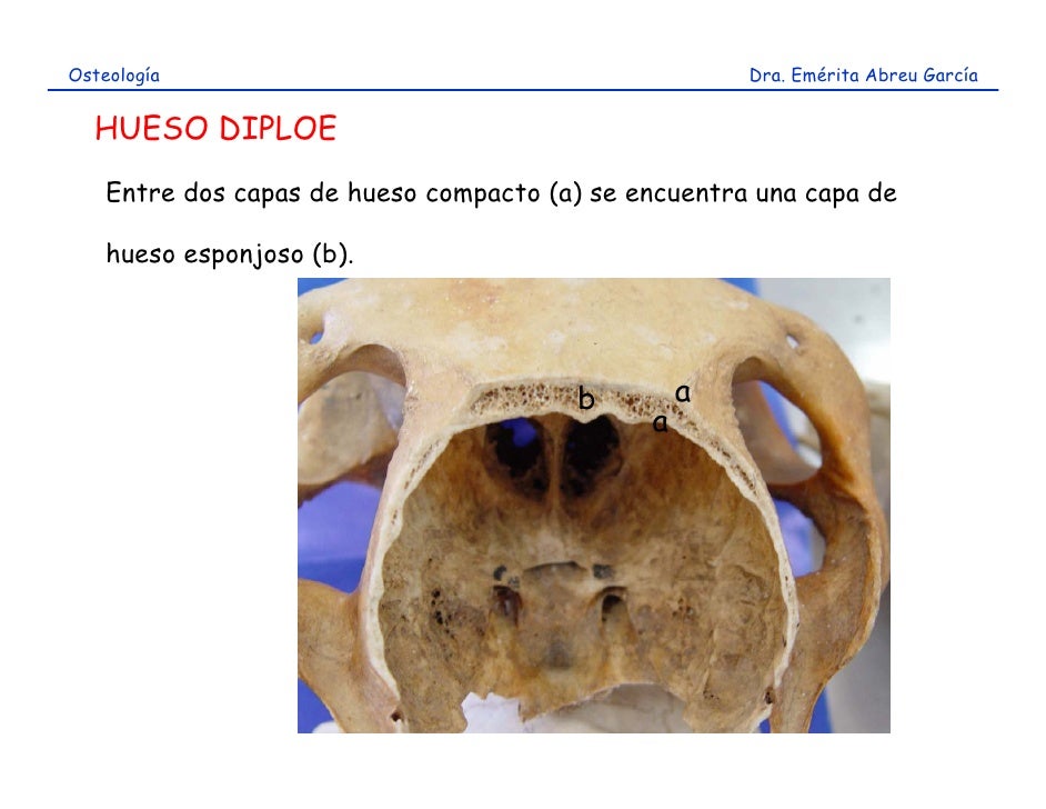 Osteología                                            Dra. Emérita Abreu García  HUESO DIPLOE    Entre dos capas de hueso ...