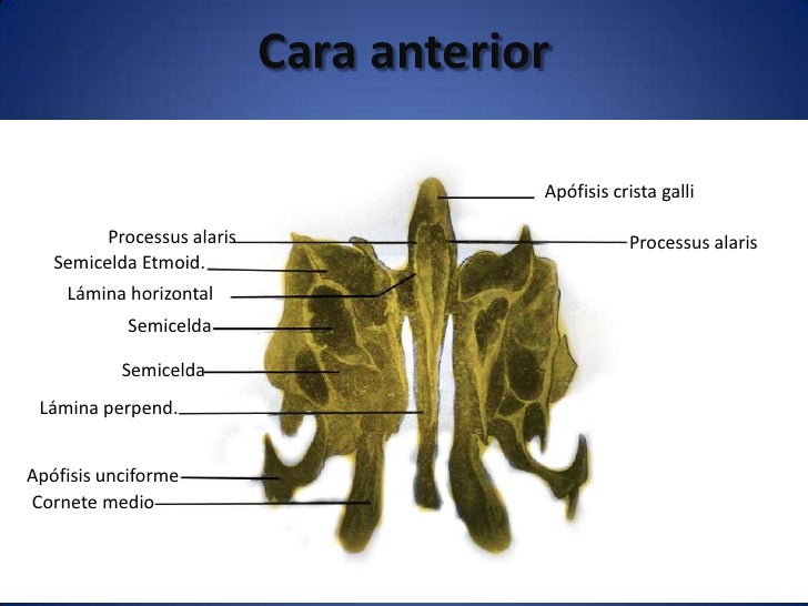 Osteología del cráneo, frontal y etmoides