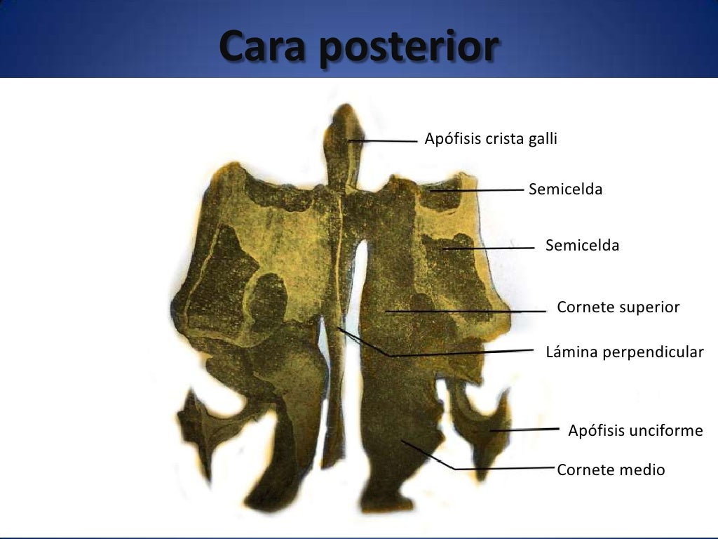 Osteología del cráneo, frontal y etmoides