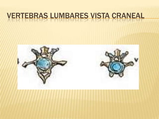 VERTEBRAS LUMBARES VISTA CRANEAL