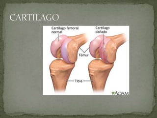 CARTILAGO