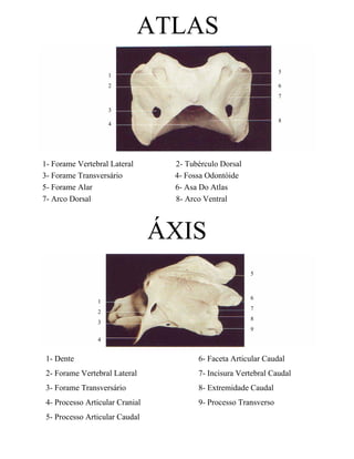 ATLAS
                                                                 5
                    1
                    2                                            6
                                                                 7

                    3
                                                                 8
                    4




1- Forame Vertebral Lateral       2- Tubérculo Dorsal
3- Forame Transversário           4- Fossa Odontóide
5- Forame Alar                    6- Asa Do Atlas
7- Arco Dorsal                    8- Arco Ventral



                                 ÁXIS
                                                        5



                                                        6
                1
                                                        7
                2
                                                        8
                3
                                                        9
                4


 1- Dente                               6- Faceta Articular Caudal
 2- Forame Vertebral Lateral            7- Incisura Vertebral Caudal
 3- Forame Transversário                8- Extremidade Caudal
 4- Processo Articular Cranial          9- Processo Transverso
 5- Processo Articular Caudal
 