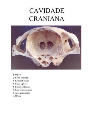 CAVIDADE
                  CRANIANA
                         1




           8             2
                                 3
7


                             4
                                 5
                             6



1- Díploe
2- Fossa Etmoidal
3- Lâmina Crivosa
4- Canal Óptico
5- Fissura Orbitária
6- Seio Esfenopalatino
7- Arco Zigomático
8- Órbita
 