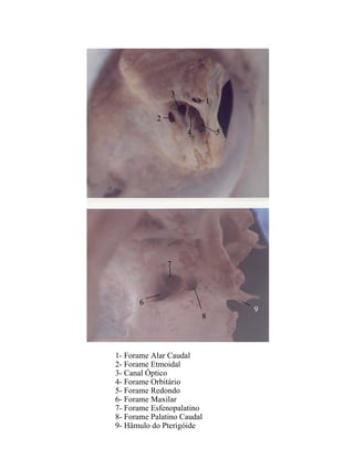 3
                            1

           2
                    4           5




               7



      6
                                    9
                        8



1- Forame Alar Caudal
2- Forame Etmoidal
3- Canal Óptico
4- Forame Orbitário
5- Forame Redondo
6- Forame Maxilar
7- Forame Esfenopalatino
8- Forame Palatino Caudal
9- Hâmulo do Pterigóide
 
