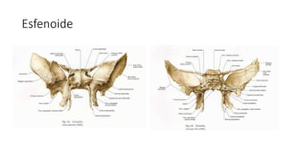 Esfenoide
 