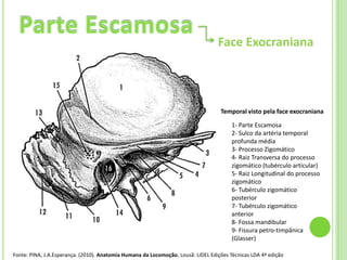Face Exocraniana




                                                                                   Temporal visto pela face exocraniana

                                                                                        1- Parte Escamosa
                                                                                        2- Sulco da artéria temporal
                                                                                        profunda média
                                                                                        3- Processo Zigomático
                                                                                        4- Raiz Transversa do processo
                                                                                        zigomático (tubérculo articular)
                                                                                        5- Raiz Longitudinal do processo
                                                                                        zigomático
                                                                                        6- Tubérculo zigomático
                                                                                        posterior
                                                                                        7- Tubérculo zigomático
                                                                                        anterior
                                                                                        8- Fossa mandibular
                                                                                        9- Fissura petro-timpânica
                                                                                        (Glasser)

Fonte: PINA, J.A.Esperança. (2010). Anatomia Humana da Locomoção. Lousã: LIDEL Edições Técnicas LDA 4ª edição
 