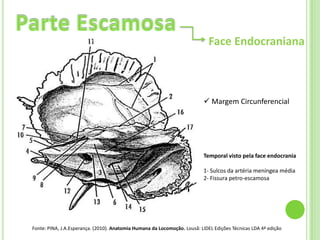 Face Endocraniana



                                                                           Margem Circunferencial




                                                                          Temporal visto pela face endocrania

                                                                          1- Sulcos da artéria meníngea média
                                                                          2- Fissura petro-escamosa




Fonte: PINA, J.A.Esperança. (2010). Anatomia Humana da Locomoção. Lousã: LIDEL Edições Técnicas LDA 4ª edição
 