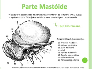  Essa parte esta situada na porção póstero-inferior do temporal (Pina, 2010);
 Apresenta duas faces (externa e interna) e uma margem circunferencial.


                                                                         Face Exocraniana



                                                                       Temporal visto pela face exocraniana

                                                                        10- Processo mastóide
                                                                        11- Incisura mastoideia
                                                                        12- Sulco da artéria
                                                                        occipital
                                                                        13- Forame mastoideu
                                                                        14- Espinha suprameática
                                                                        15- Zona cribiforme
                                                                        16- Poro acústico externo


   Fonte: PINA, J.A.Esperança. (2010). Anatomia Humana da Locomoção. Lousã: LIDEL Edições Técnicas LDA 4ª edição
 