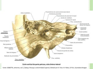 Corte vertical da parte petrosa, vista ântero-lateral
Fonte: SOBOTTA, Johannes, vol.1, Cabeça, Pescoço e extremidade Superior, Editado por R. Putz e R. Pabst, 21ª Ed., Guanabara Koogan.
 