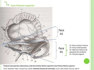 Face Póstero-superior




                                                                                                    12- Poro acústico interno
                                                                                                    13- Fossa subarqueada
                                                                                                    14- Abertura externa do
                                                                                                    aqueduto do vestíbulo
                                                                                                    15- Fóssula ungueal




Temporal visto pela face endocraniana, onde Face AS (Face Ântero-superior) e Face PS (Face Póstero-superior)
Fonte: Adaptado: PINA, J.A.Esperança. (2010). Anatomia Humana da Locomoção. Lousã: LIDEL Edições Técnicas LDA 4ª
 