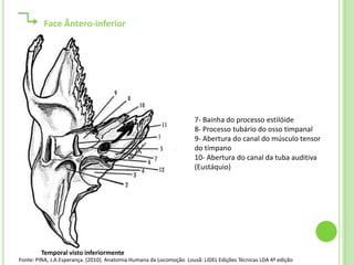 Face Ântero-inferior




                                                                     7- Bainha do processo estilóide
                                                                     8- Processo tubário do osso timpanal
                                                                     9- Abertura do canal do músculo tensor
                                                                     do tímpano
                                                                     10- Abertura do canal da tuba auditiva
                                                                     (Eustáquio)




        Temporal visto inferiormente
Fonte: PINA, J.A.Esperança. (2010). Anatomia Humana da Locomoção. Lousã: LIDEL Edições Técnicas LDA 4ª edição
 