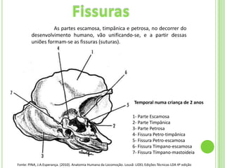 As partes escamosa, timpânica e petrosa, no decorrer do
        desenvolvimento humano, vão unificando-se, e a partir dessas
        uniões formam-se as fissuras (suturas).




                                                                         Temporal numa criança de 2 anos

                                                                        1- Parte Escamosa
                                                                        2- Parte Timpânica
                                                                        3- Parte Petrosa
                                                                        4- Fissura Petro-timpânica
                                                                        5- Fissura Petro-escamosa
                                                                        6- Fissura Tímpano-escamosa
                                                                        7- Fissura Tímpano-mastoideia

Fonte: PINA, J.A.Esperança. (2010). Anatomia Humana da Locomoção. Lousã: LIDEL Edições Técnicas LDA 4ª edição
 