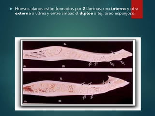  Huesos planos están formados por 2 láminas: una interna y otra
externa o vítrea y entre ambas el díploe o tej. óseo esponjoso.
 
