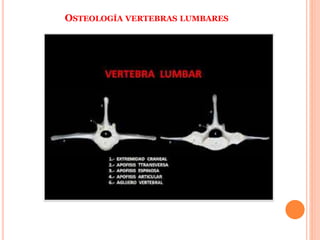 OSTEOLOGÍA VERTEBRAS LUMBARES
 