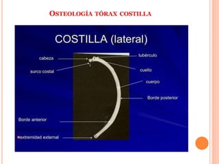 OSTEOLOGÍA TÓRAX COSTILLA
 