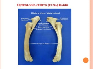 OSTEOLOGÍA CUBITO (ULNA) RADIO
 