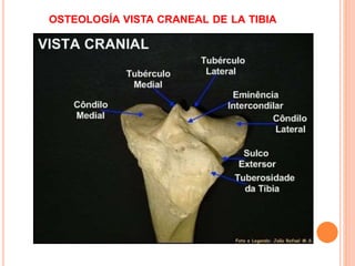 OSTEOLOGÍA VISTA CRANEAL DE LA TIBIA
 