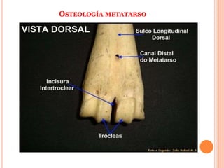 OSTEOLOGÍA METATARSO
 