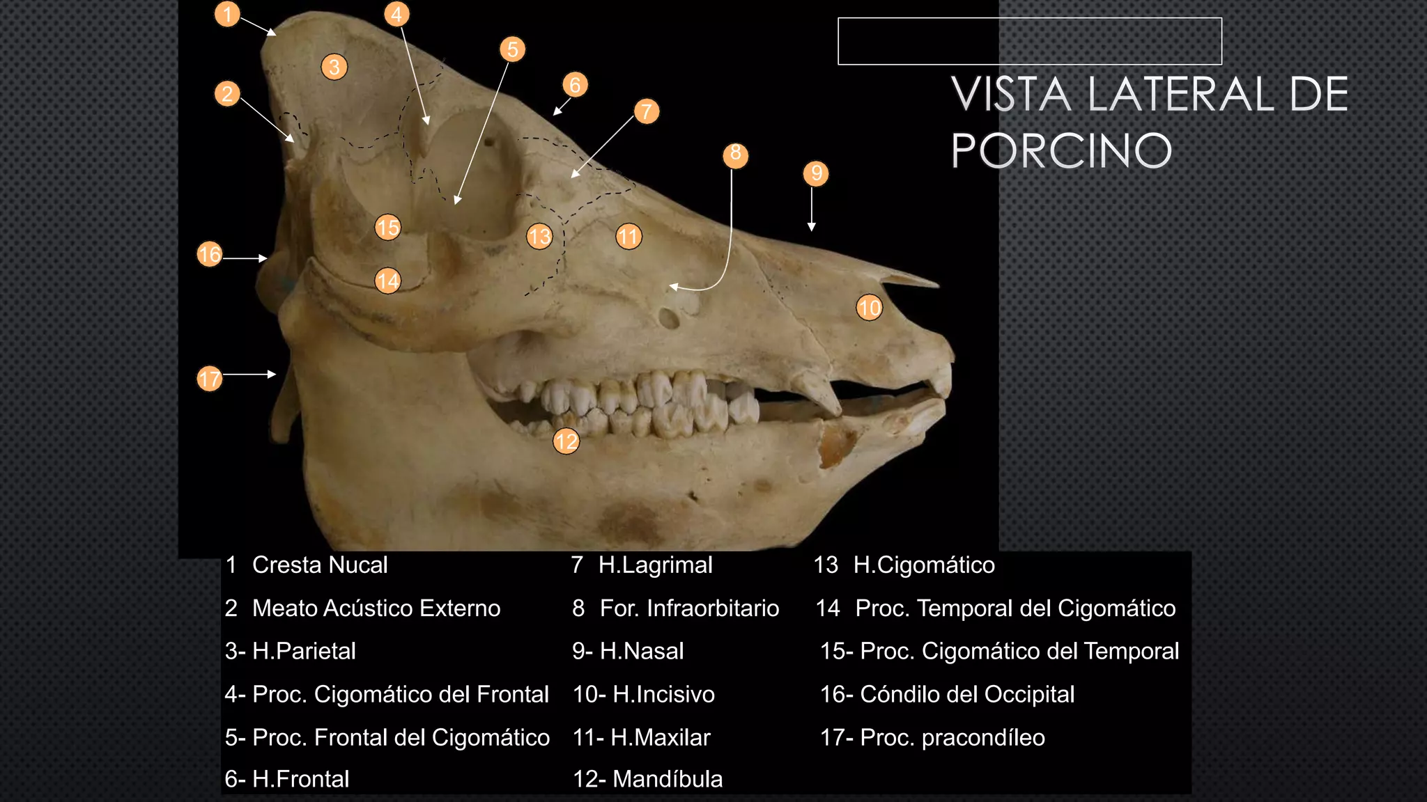 Osteología De Cabeza Pdf