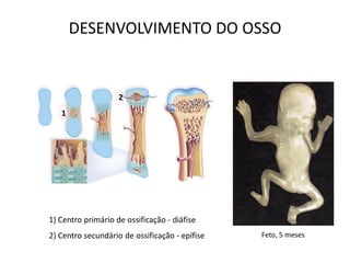 DESENVOLVIMENTO DO OSSO


                    2
   1




1) Centro primário de ossificação - diáfise
2) Centro secundário de ossificação - epífise   Feto, 5 meses
 