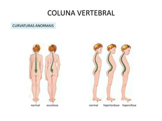 COLUNA VERTEBRAL
CURVATURAS ANORMAIS




        normal   escoliose   normal   hiperlordose hipercifose
 