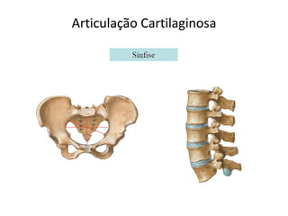 Articulação Cartilaginosa
 