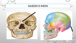 NASION E INION
 