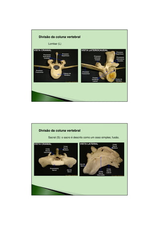 23/08/2010




Divisão da coluna vertebral

      Lombar (L)




Divisão da coluna vertebral

      Sacral (S): o sacro é descrito como um osso simples; fusão.




                                                                           10
 
