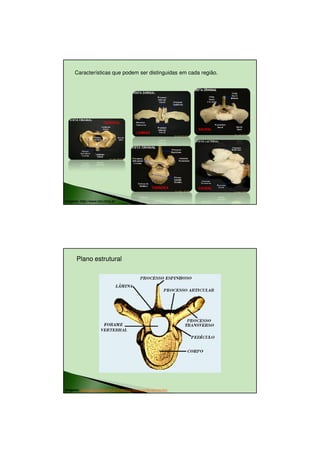 23/08/2010




      Características que podem ser distinguidas em cada região.




                         CERVICAL

                                                                     SACRAL
                                             LOMBAR




                                                       TORÁCICA      CAUDAL



Imagens: http://www.icb.ufmg.br




       Plano estrutural




Imagens: http://www.sogab.com.br/anatomia/colunavertebraljonas.htm




                                                                                      3
 