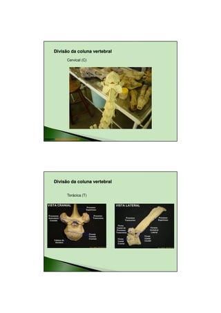 23/08/2010




        Divisão da coluna vertebral
                   Cervical (C)




Imagens: http://www.icb.ufmg.br




        Divisão da coluna vertebral


                   Torácica (T)




                                              9
 