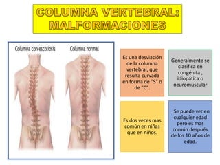 Es una desviación
de la columna
vertebral, que
resulta curvada
en forma de "S" o
de "C".
Generalmente se
clasifica en
congénita ,
idiopática o
neuromuscular
Es dos veces mas
común en niñas
que en niños.
. Se puede ver en
cualquier edad
pero es mas
común después
de los 10 años de
edad.
 