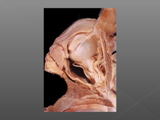Osteologie cranio faciale