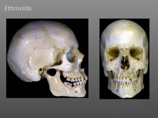 Ethmoïde
 
