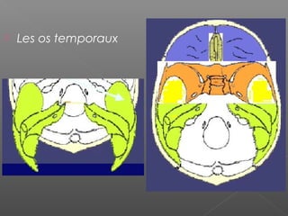  Les os temporaux
 