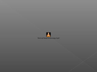 Normal Nasal Endoscopy.mp4
 
