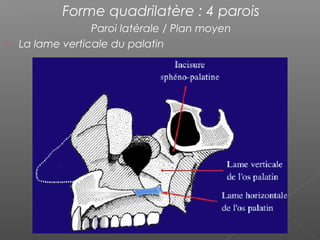 Forme quadrilatère : 4 parois
Paroi latérale / Plan moyen
 La lame verticale du palatin
 