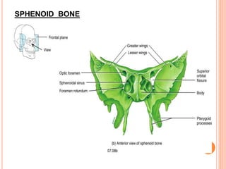 SPHENOID BONE
 
